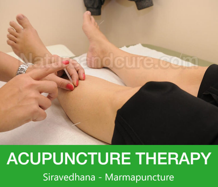 Acupuncture Therapy - Siravedhana - Marmapuncture