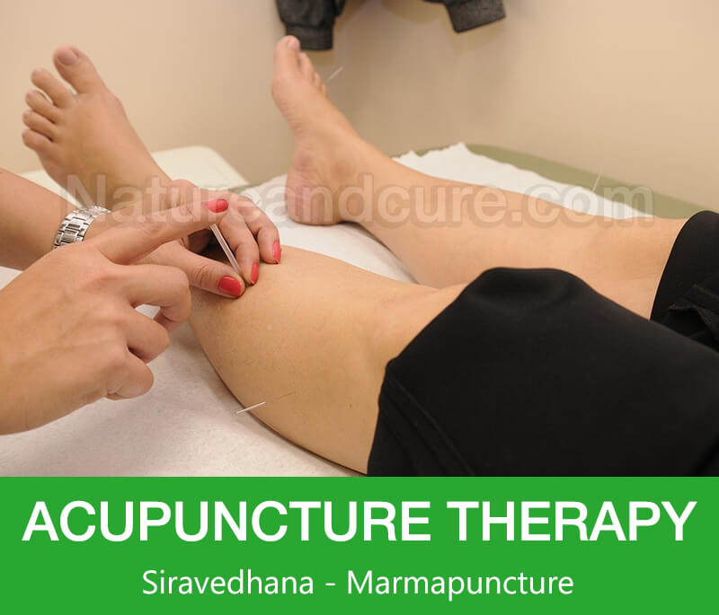 Acupuncture Therapy - Siravedhana - Marmapuncture
