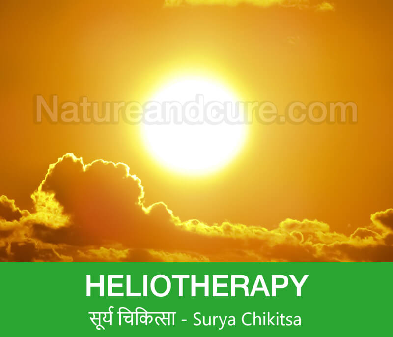 Heliotherapy - सूर्य चिकित्सा– Surya chikitsa