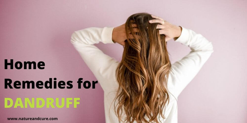 Home Remedies for Dandruff