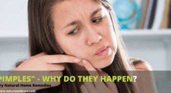 Home Remedies for Pimples