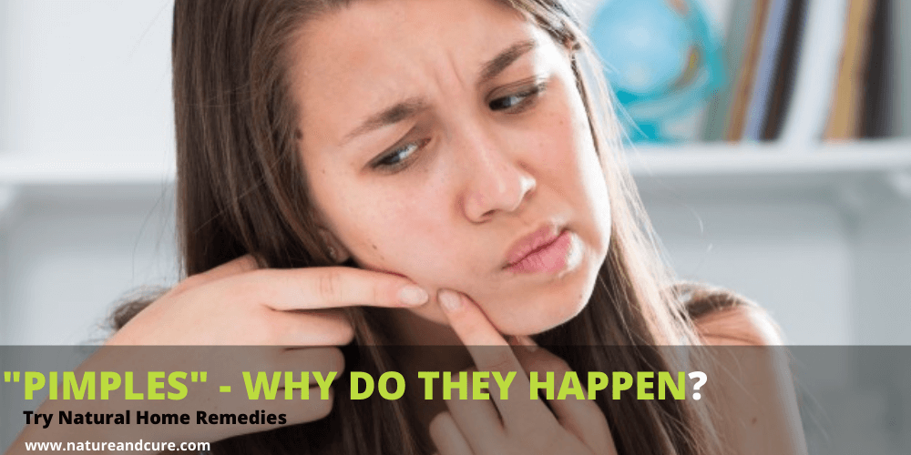 Home Remedies for Pimples