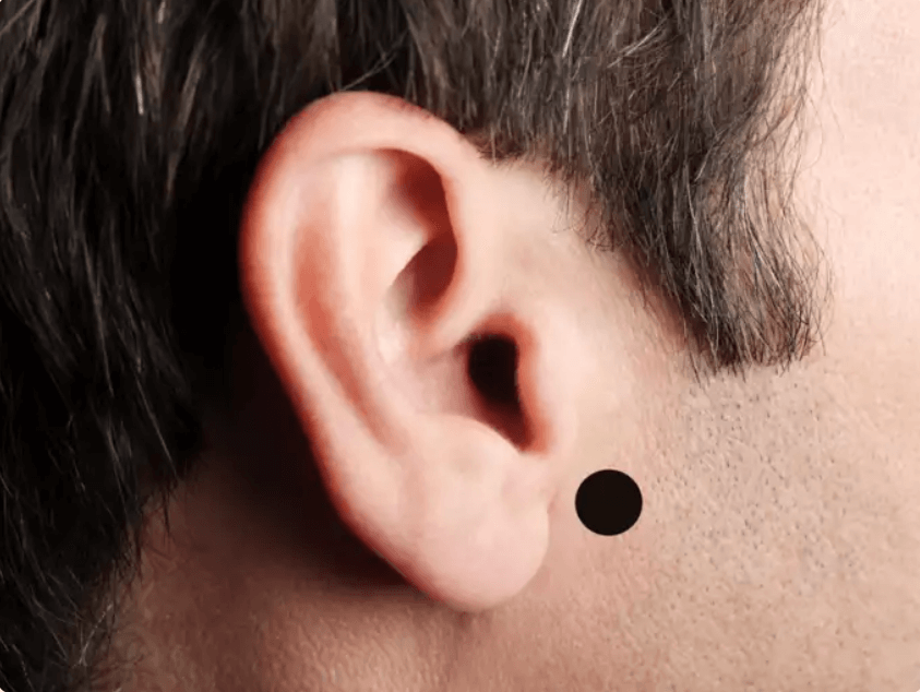 Ear Acupressure Point