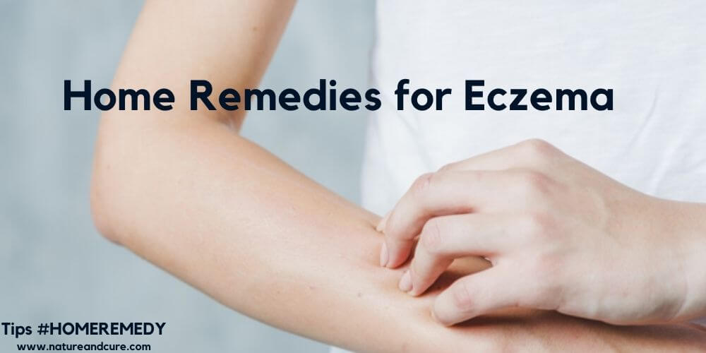eczema