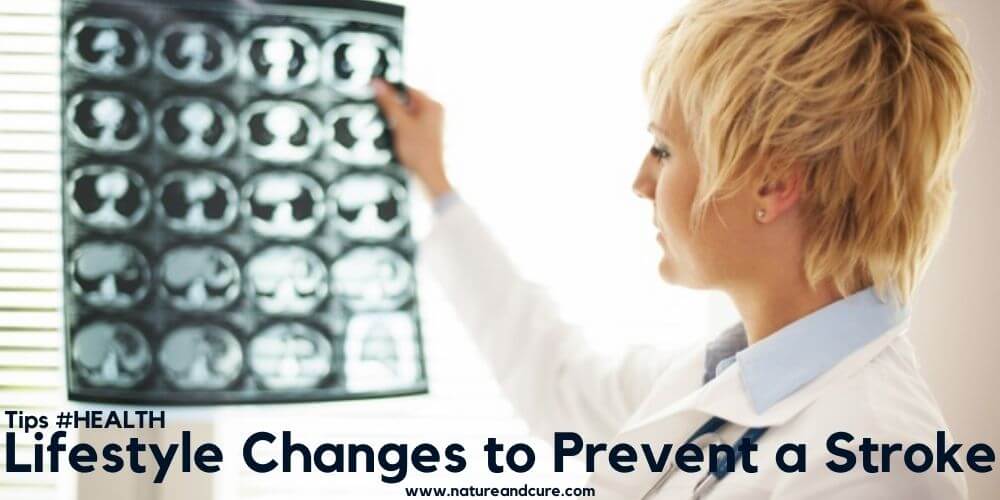 Lifestyle Changes to Prevent a Stroke