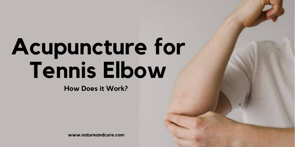 Acupuncture for Tennis Elbow