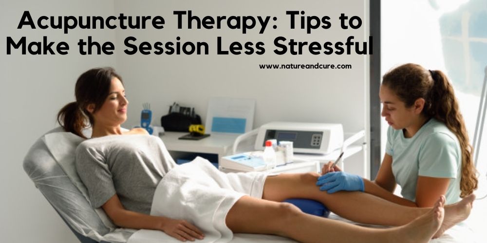 Acupuncture Therapy: Tips to Make the Session Less Stressful
