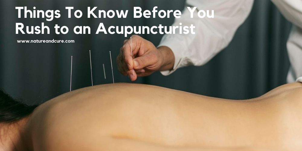 Acupuncture