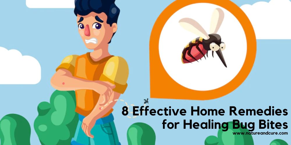 Home Remedies for Bug Bites