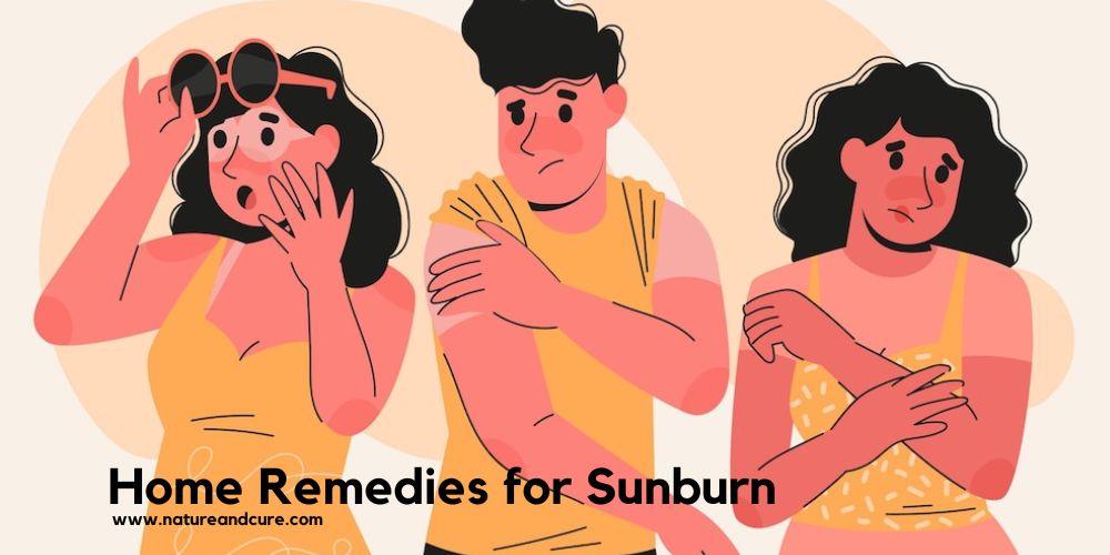sunburn