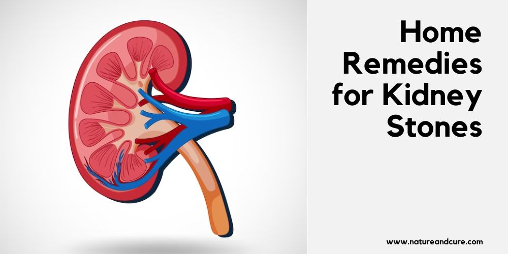 Home Remedies for Kidney Stones