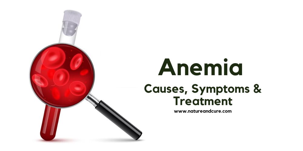 Anemia